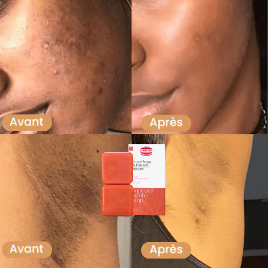 Savon Vitamine C