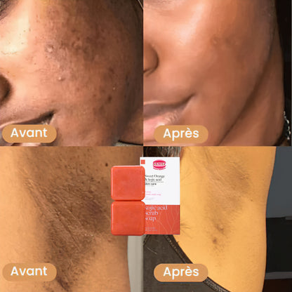 Savon Vitamine C